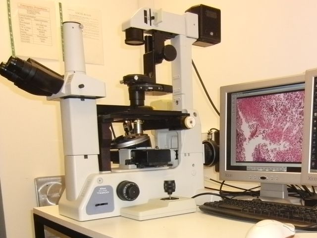 picture of Lister microscope