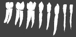 Teeth - Click to enter White Teeth